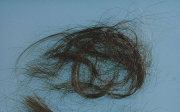 Svědění hlavy a padání vlasů